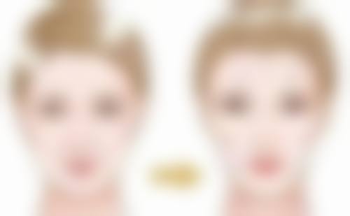 吉林大学第一医院揭秘：骨粉隆鼻至佳取出时机