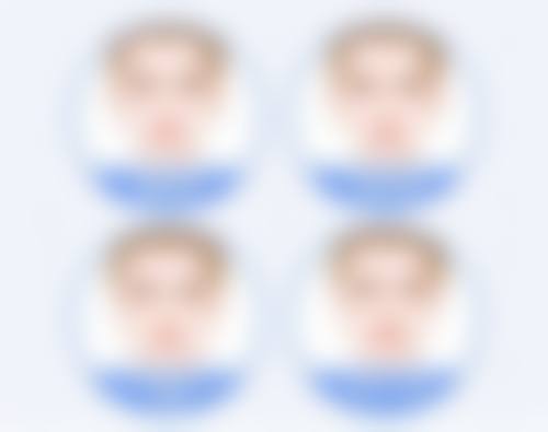 瘦脸针什么时候效果最佳？1-2周见效，1-2个月达到巅峰，3-6个月持久稳定！