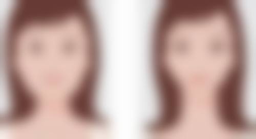 北京协和医院提醒：骨粉隆鼻出现这些症状必须取出