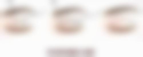 瘦脸针什么时候成效至佳：1 - 2个月容貌巅峰的惊艳蜕变