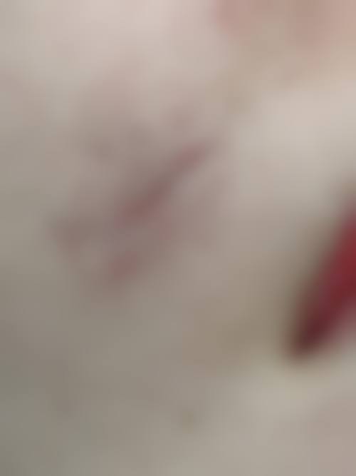 七、武汉禾丽康美整形医院怎么样：口碑好不好？附真实患者口碑评价