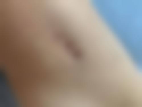 郑州安美星河医疗美容门诊部顾客实例