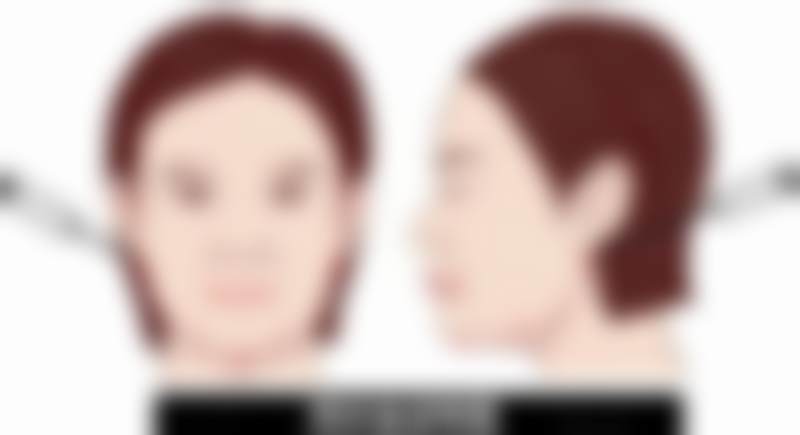 广州高尚医学美容中 心曾江术后护理要点