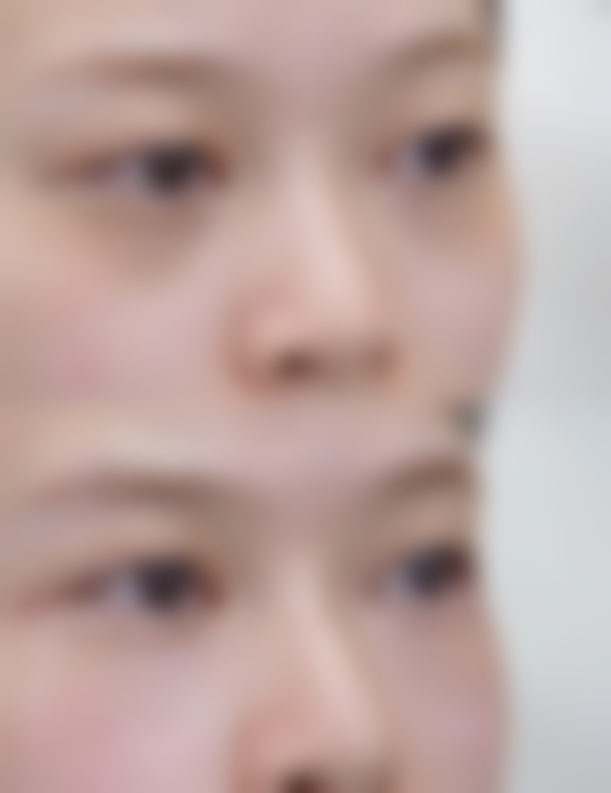 武汉斯启诺医疗美容门诊部刘敏先是渠道医生吗——武汉五洲莱美整形医院