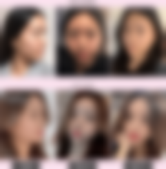 李允焕医生顾客实例图片