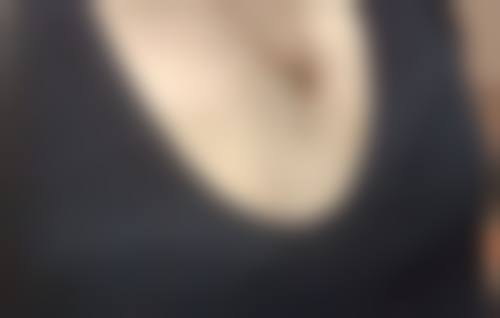 做了双眼皮以后眼皮松弛的预防方法——精心呵护，防患未然