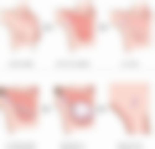 40岁女人手术去眼袋的成效分析：精细抉择，重塑眼颜