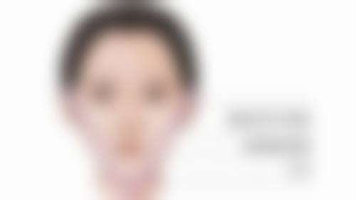 张莉云医生做手术价格