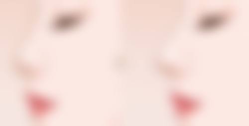 隆鼻一般能管多久——膨体隆鼻：15年“超长待机”的实力派