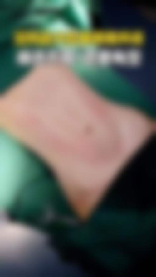 王丽珊医生做手术价格