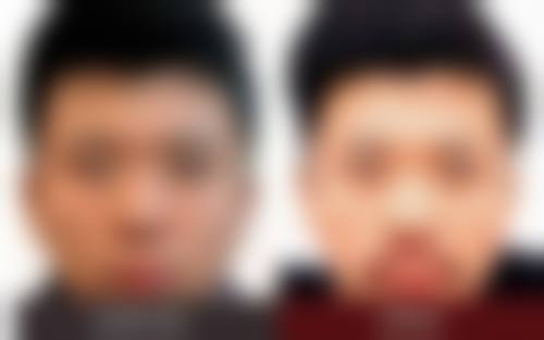 资阳精美源整形医院怎么样——项目特色