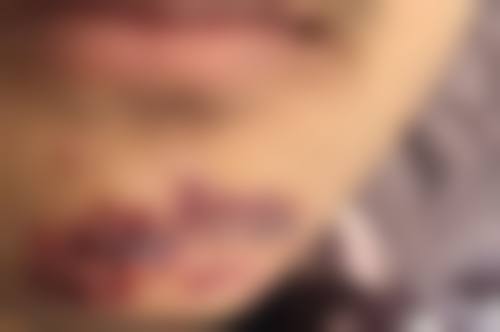 枣庄市中玖美医疗美容门诊部价格表是怎样的