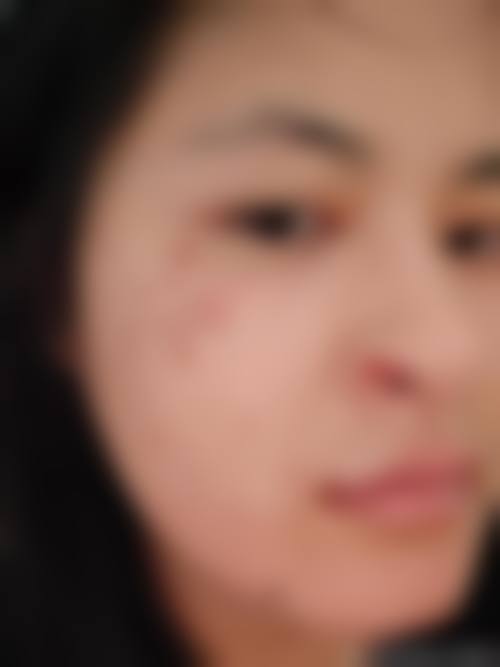 西安美人鱼医疗美容口碑好不好，怎么样