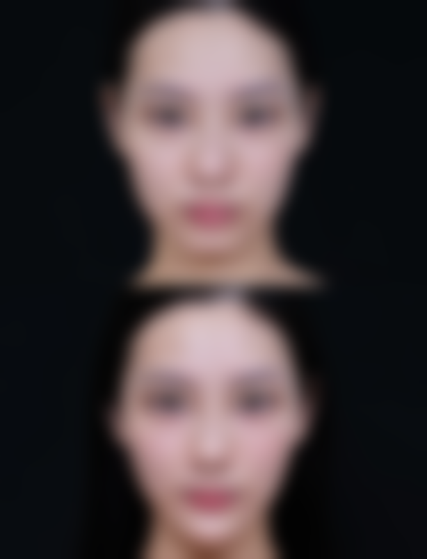 西安美人鱼医疗美容抖音团购活动和价格表怎么样