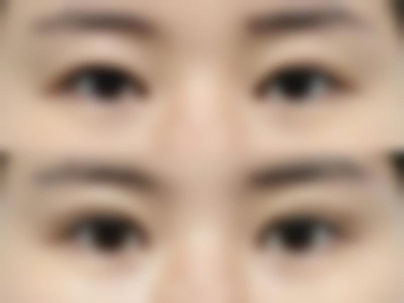 厦门思明美英雅韩整形外科门诊部价格表