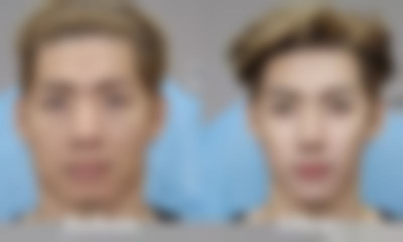 天津珍熙美医疗美容怎么样，正规吗？