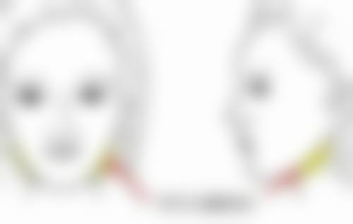 怎么样去除衰老型眼袋：医院前列技术的时光逆转魔法