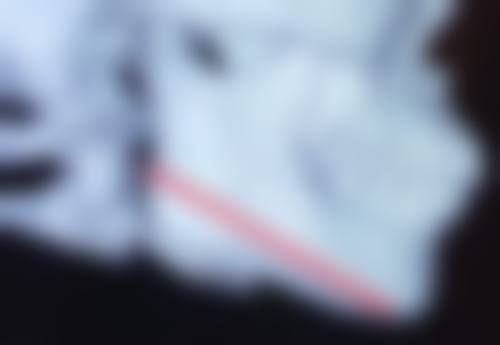 熬夜有黑眼圈眼袋怎么消除？3招急救按摩+冷敷热敷法快速消肿