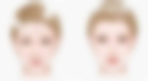 做假体隆胸哪些人不适合