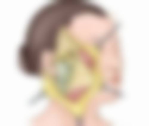 做假体隆胸硅胶与盐水假体安心可靠性对比