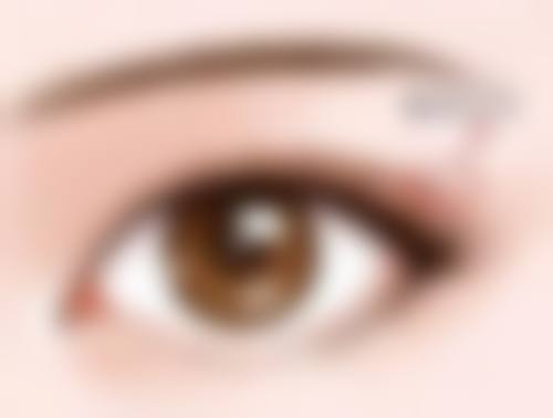 刘亚莉医生简介做手术价格