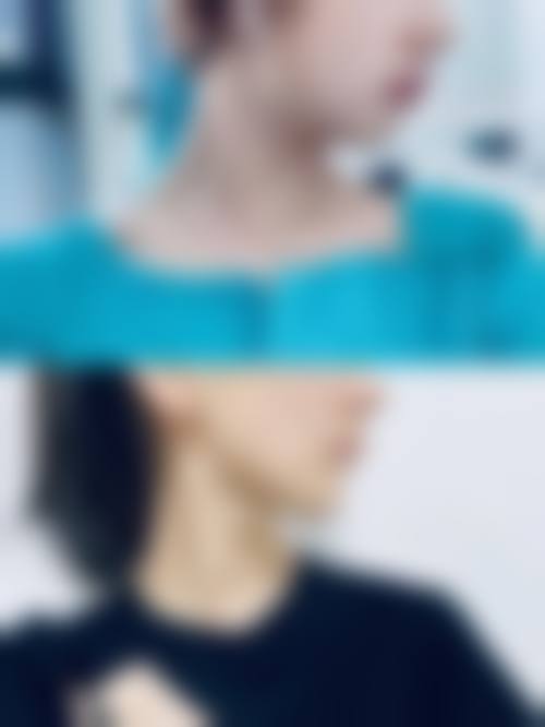 南宁千美子整形美容诊所怎么样：更擅长什么手术