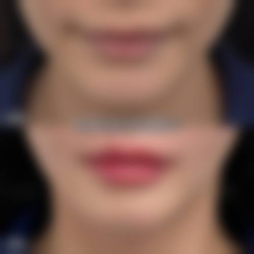 包头昆区丽科医疗美容门诊部怎么样