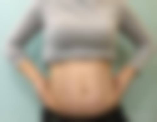 七、成都轻一整形医院怎么样——口碑好不好？附真实患者口碑评价