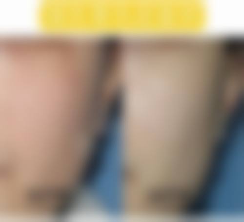 潍坊博雅医疗美容整形医院项目特色