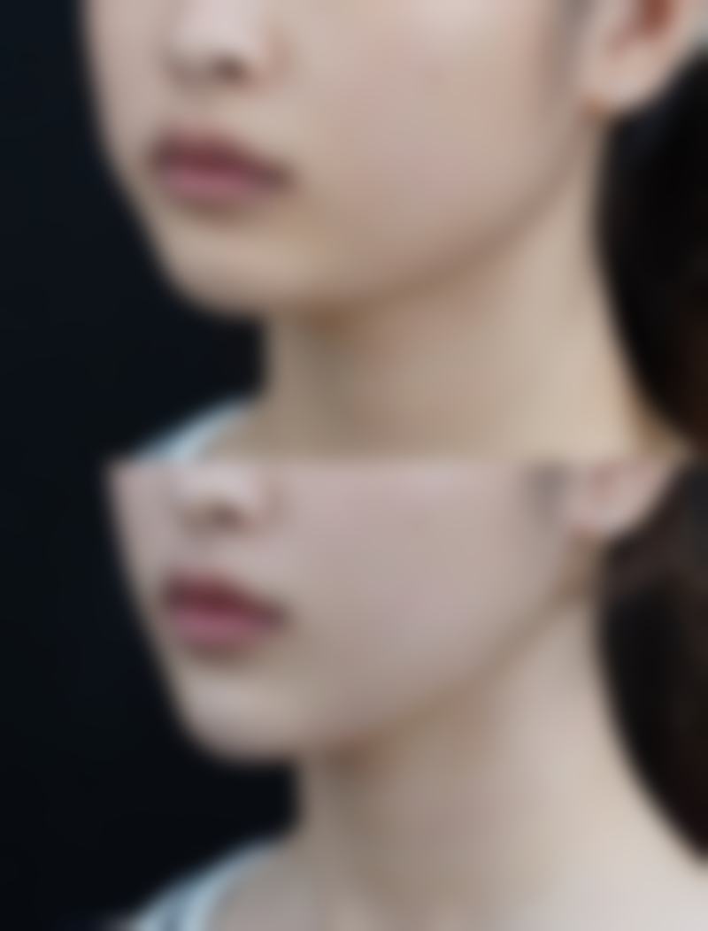 韩国DIONE吸脂皮肤门诊是否正规