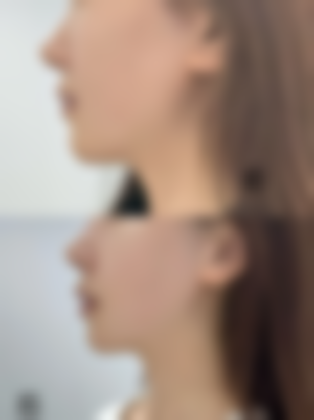 南宁千美子整形美容诊所怎么样：评价