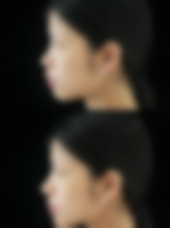 消除眼袋的10种方法之睡眠调整：美容觉里，焕发光彩