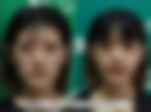 冰敷眼睛消眼袋的适用人群