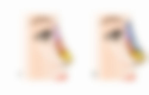 耐心等待：疤痕用芦荟胶多久有成效