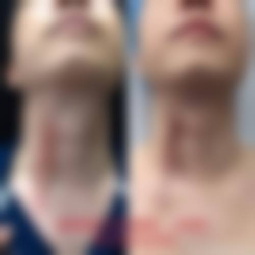 张俊艳医生简介之做手术价格