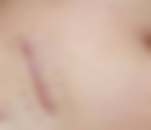 朔州华美张鹏整形医院口碑好不好？附真实患者口碑评价