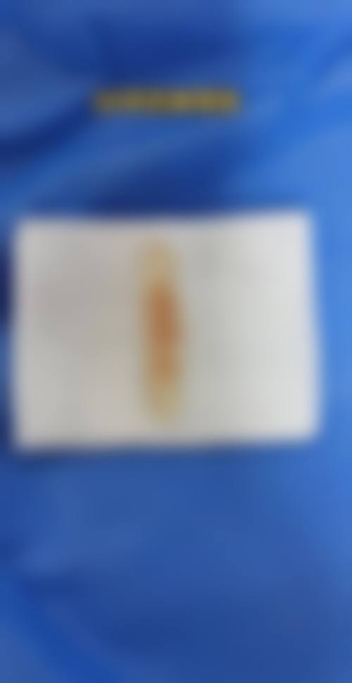 罗全生医生简介做手术价格