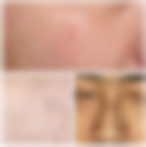 张素姣医生的项目优势特色