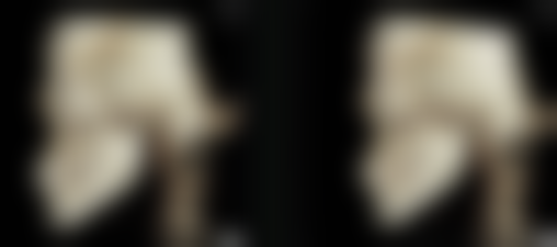 肚子大抽脂会反弹吗?三大元凶让脂肪卷土重来