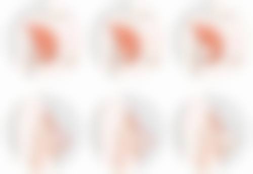 郑娜医生简介做手术价格