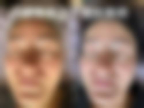 黑龙江张克宁西整形医医疗美容科诊所价格表