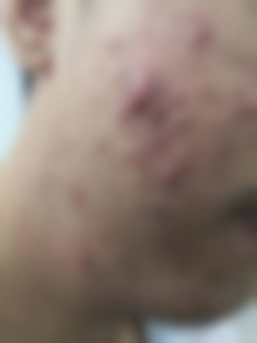 韩国CK整形外科怎么样，黄在弘院长技术如何？