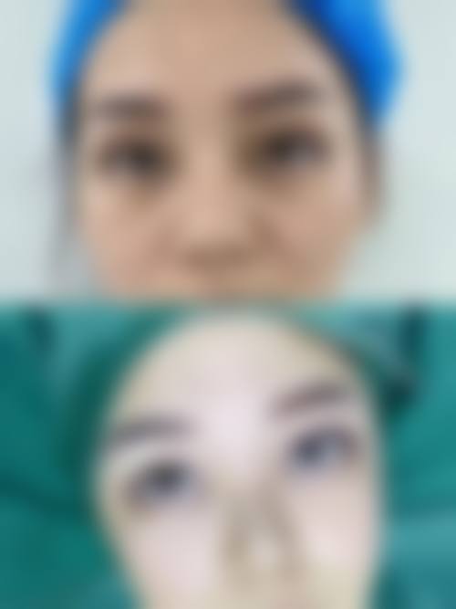 俞惠忠医生项目优势