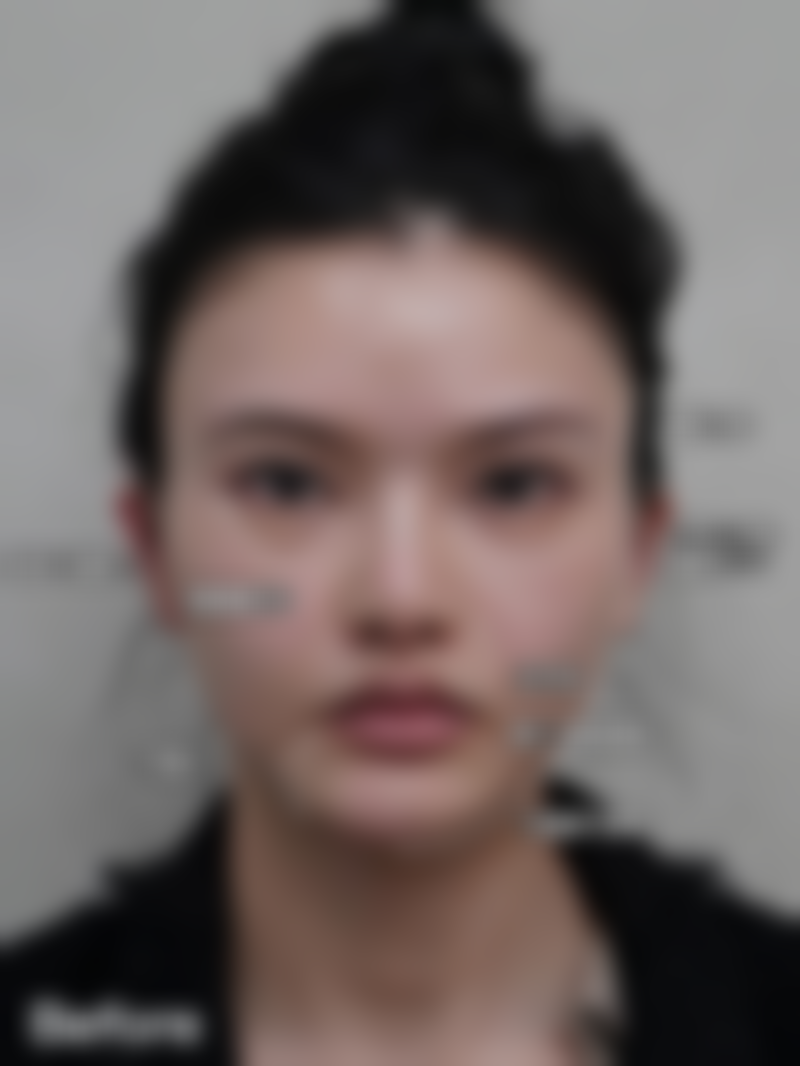 西安艺星医疗美容医院李国玲收费贵不贵——西安画美整形美容医院