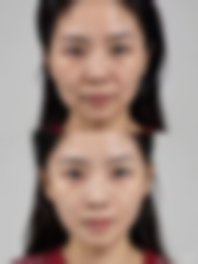 韩国CK整形外科怎么样，口碑好不好？