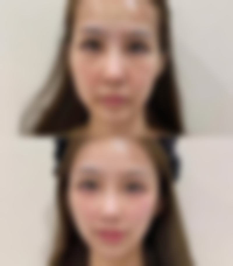 韩国CK整形外科怎么样，医生简介