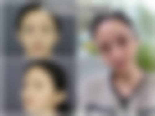 方医生生简介做手术价格