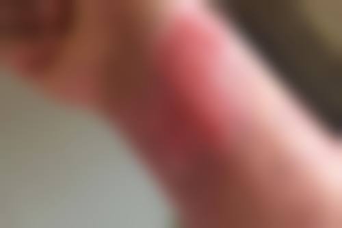 佟淑杰医生简介口碑如何