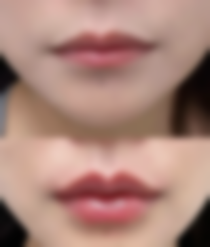 易同明医生做手术价格