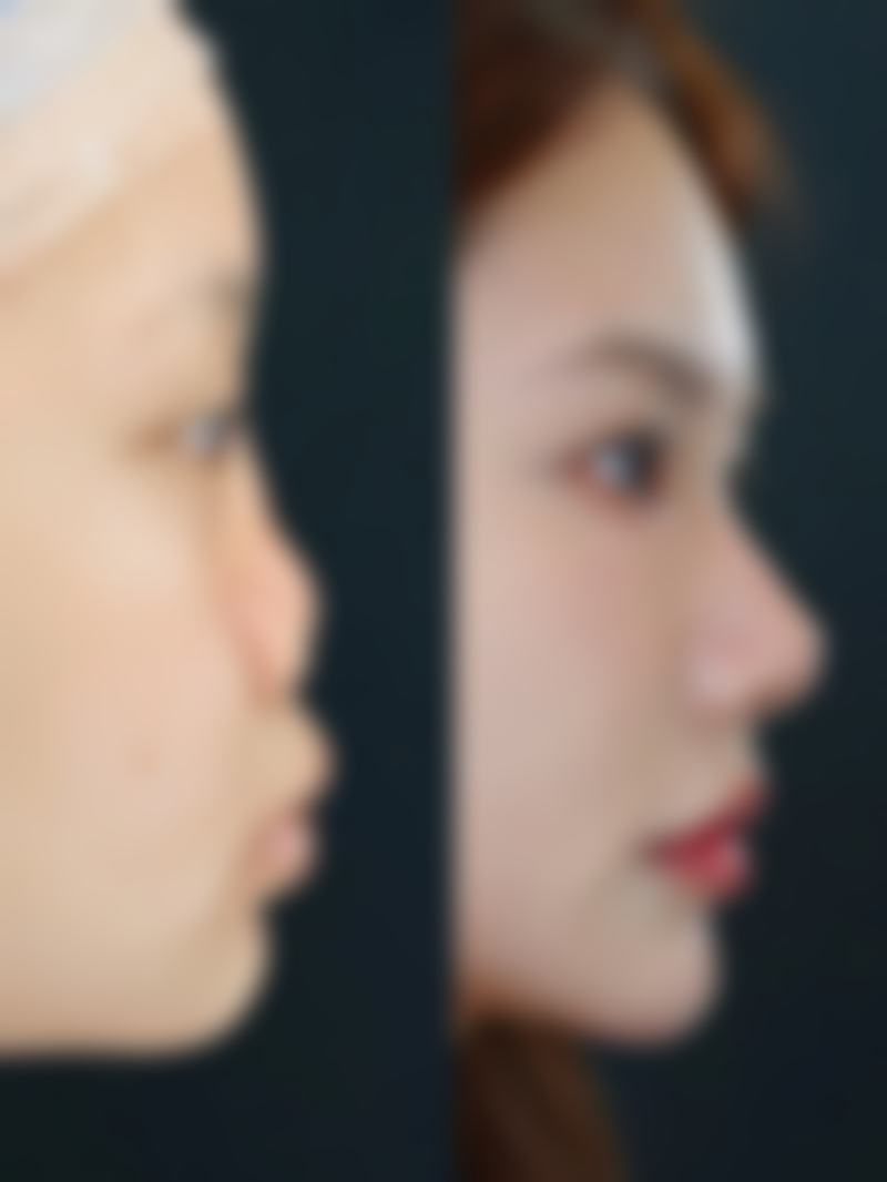 钟亮医生简介做手术价格